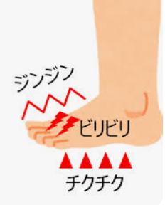 末梢神経障害