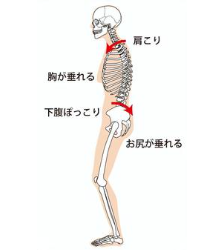 猫背